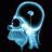 Anencephalus